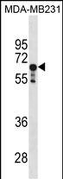 PPP2R1A Antibody(C-term)