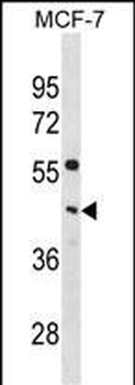 PCYT1A Antibody(C-term)