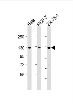 XPC Antibody(N-term)