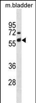 Mouse Krt6a Antibody(Center)
