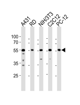 SRC Antibody(N-term)