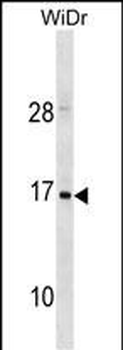 HBZ Antibody(C-term)