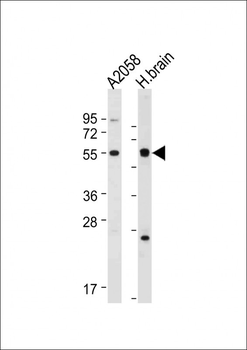 TMX3 Antibody(C-term)
