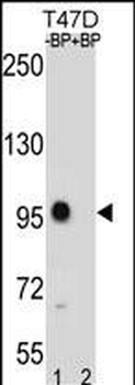 CTNNB1 Antibody(C-term)
