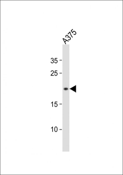 CDKN2A Antibody(N-term S8)