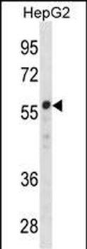ZNF276 Antibody(Center)