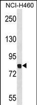 Mouse Dyrk1a Antibody(C-term)