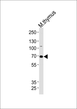 Mouse Ephb6 Antibody(Center)