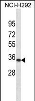 PRRX1 Antibody(C-term)