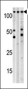 Cellular Apoptosis Susceptibility Antibody (C-term)