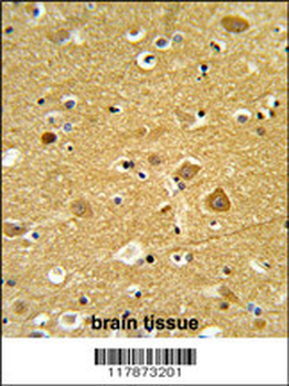 TNPO1 Antibody (N-term)
