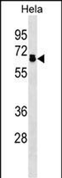 PPP2R5D Antibody (N-term)