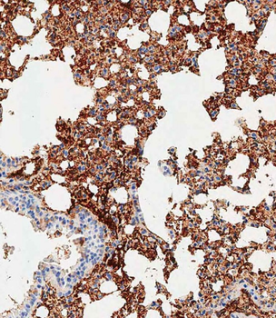 Mouse Trem2 Antibody (N-term)