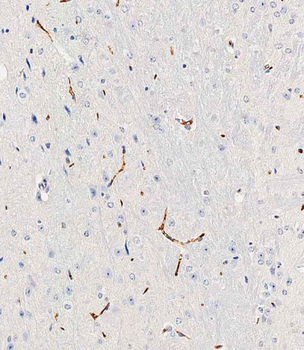 Mouse Trem2 Antibody (N-term)