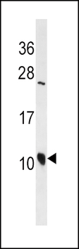 DEFA3 Antibody (C-term)