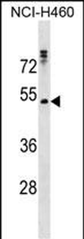 RHCG Antibody (Center)