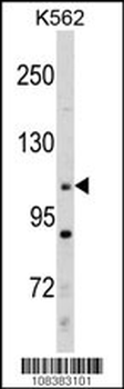 MLLT10 (AF10) Antibody (Center)