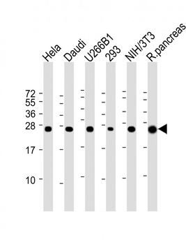RPL10 Antibody (N-term)
