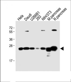 RPL10 Antibody (N-term)