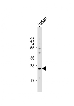 GAS41 (YEATS4/NuBI-1) Antibody (N-term F2)