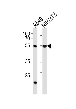 TBX4 Antibody (N-term)