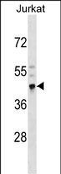 CRELD2 Antibody (N-term)