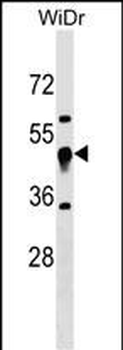 UQCRC1 Antibody (N-term)