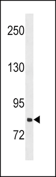 SLCO1B3 Antibody (C-term)