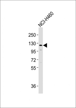 SLCO1B3 Antibody (C-term)