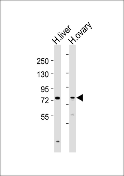 SLCO1B3 Antibody (C-term)