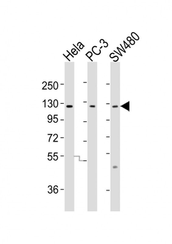 SLCO1B3 Antibody (C-term)