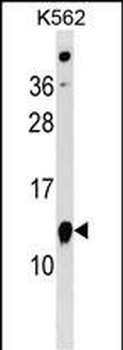 ATPIF1 Antibody (N-term)