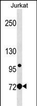 LCP1 Antibody (Center)
