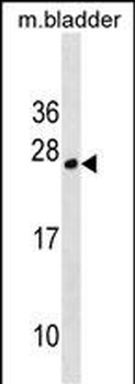 TPD52L1 Antibody (N-term)