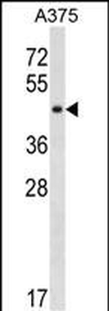 SUGT1 Antibody (C-term)