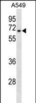 HAS3 Antibody (Center)