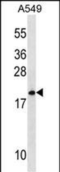 MRPL40 Antibody (C-term)
