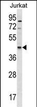 GDE1 Antibody (Center)