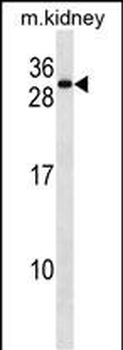 REEP5 Antibody (C-term)