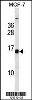 HIST1H2BH/HIST1H2BK/HIST3H2BB Antibody (Center)