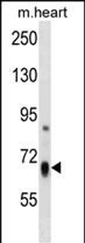 HBS1L Antibody (Center)