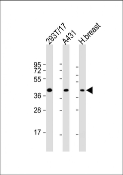 ERLIN2 Antibody (C-term)