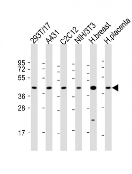 ERLIN2 Antibody (C-term)