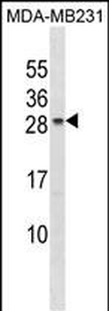 CHMP5 Antibody (C-term)