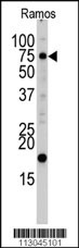 UVRAG Antibody (C-term L555)