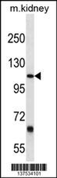 PTGFRN Antibody (Center)