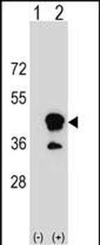 CD1B Antibody (N-term)