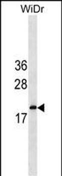 IFNA5 Antibody (C-term)