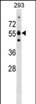 GRWD1 Antibody (Center)
