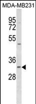 FAHD2B Antibody (C-term)